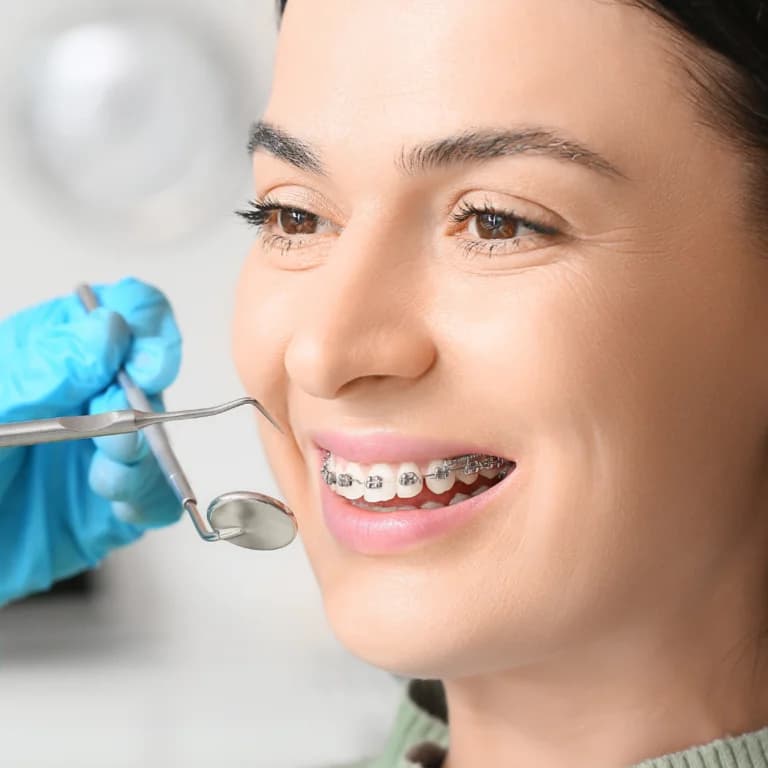 Teeth Straightening